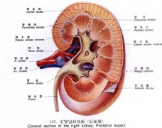 合理的饮食能将肾结石“拒之门外”